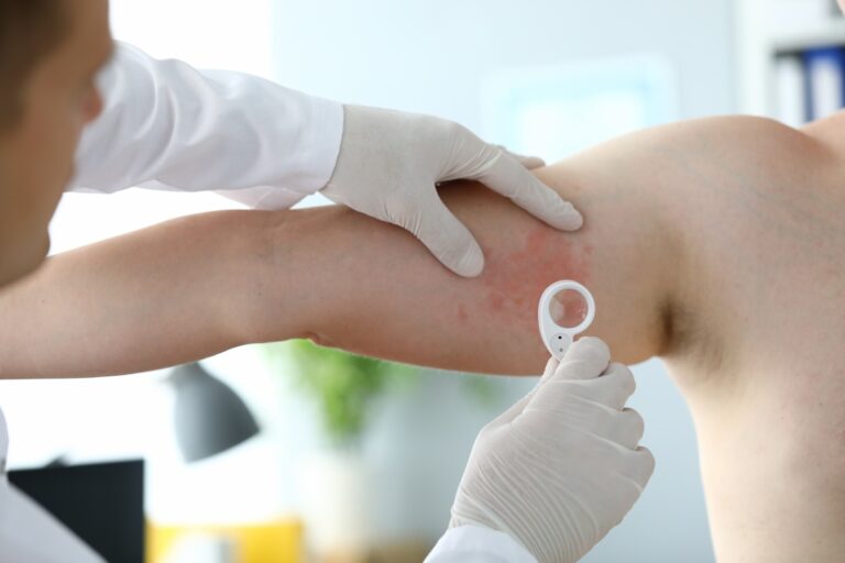 Skin Conditions